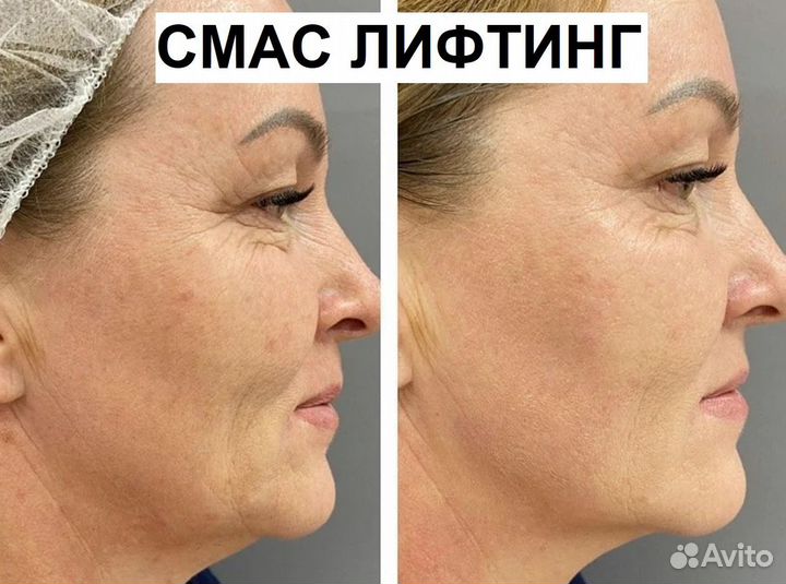 Четкий овал лица