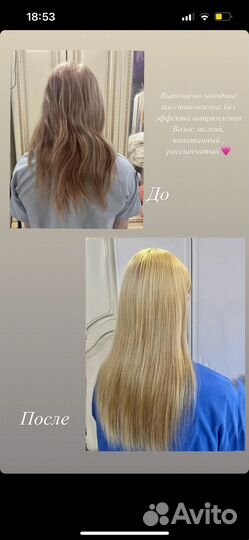 Ботокс, холодное восстановление
