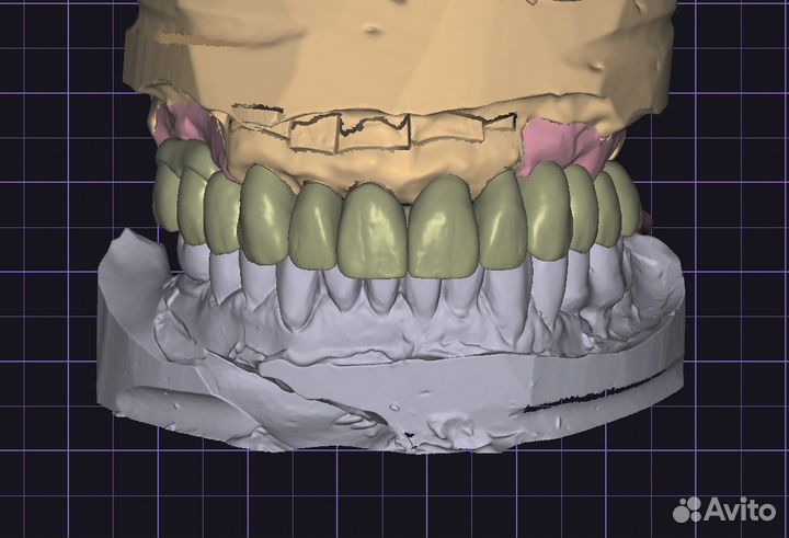 Зубной техник cad cam