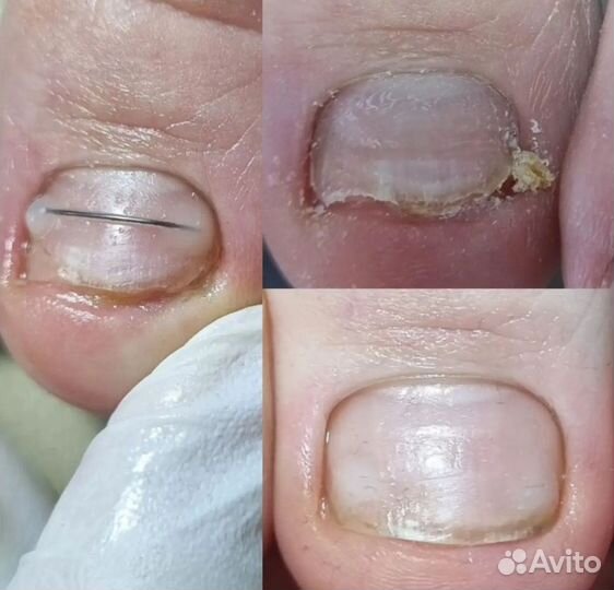 Подолог, маникюр, педикюр