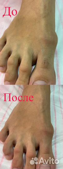 Шугаринг/ Восковая депиляция