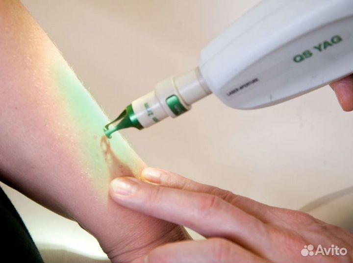 Успешная франшиза лазерной эпиляции ждёт вас