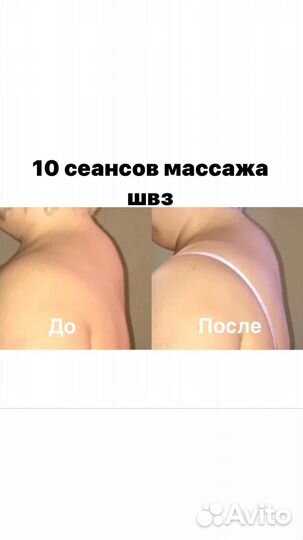 Массаж, Карамельная липосакция