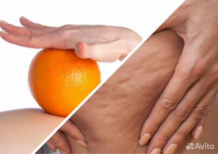 Услуги массажа