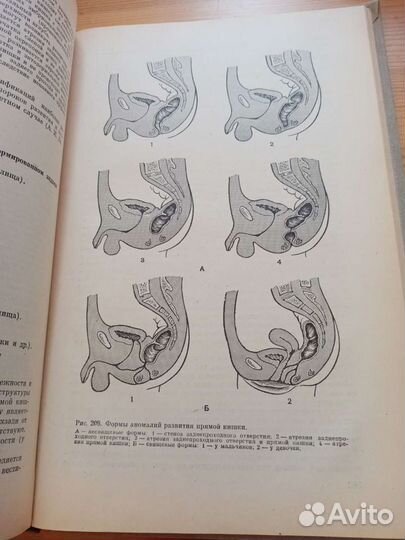 Детская хирургия. Ю. Ф. Исаков. С. Я. Долецкий