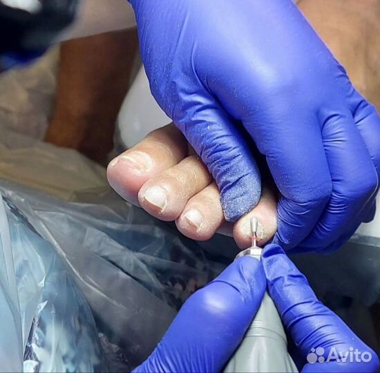 Педикюр