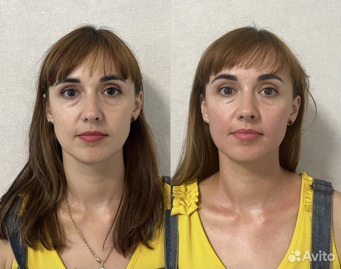 Миофасциальный массаж+Буккальный массаж