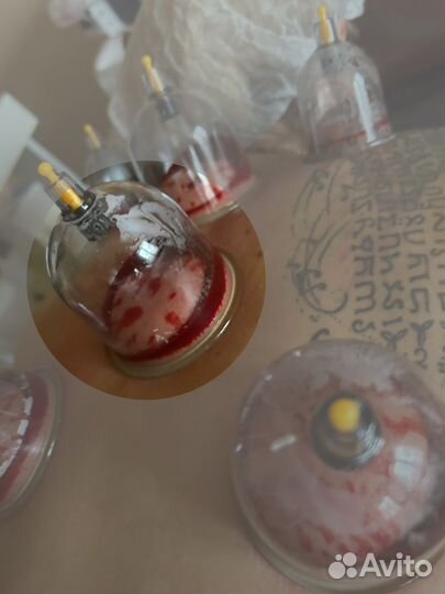 Постановка вакуумных банок для лица/ тела