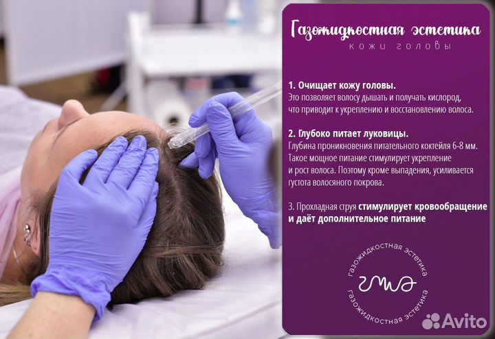 Выпадение волос, алопеция,жирность кожи головы