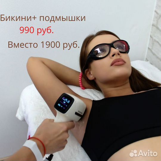 Лазерная эпиляция