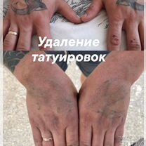 Косметолог, удаление тату, ботокс, увеличение губ, Видное