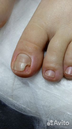 Подолог, мастер педикюра