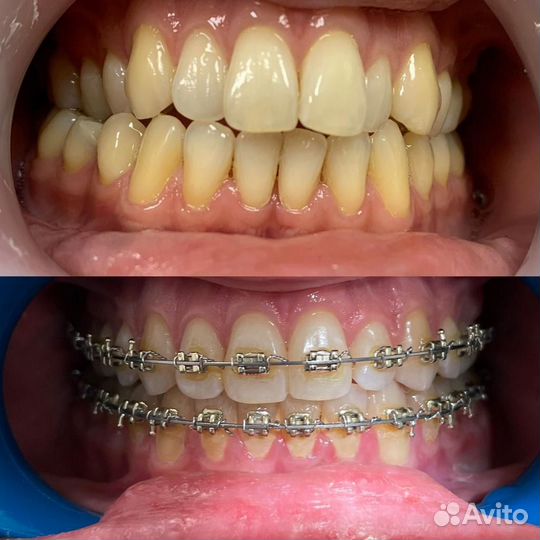 Зубной техник ортодонт