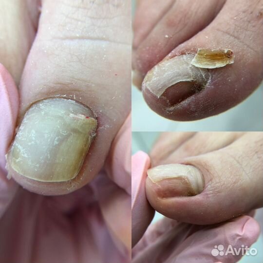 Курсы педикюра подология