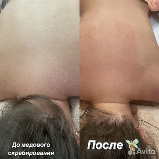 Массаж на дому