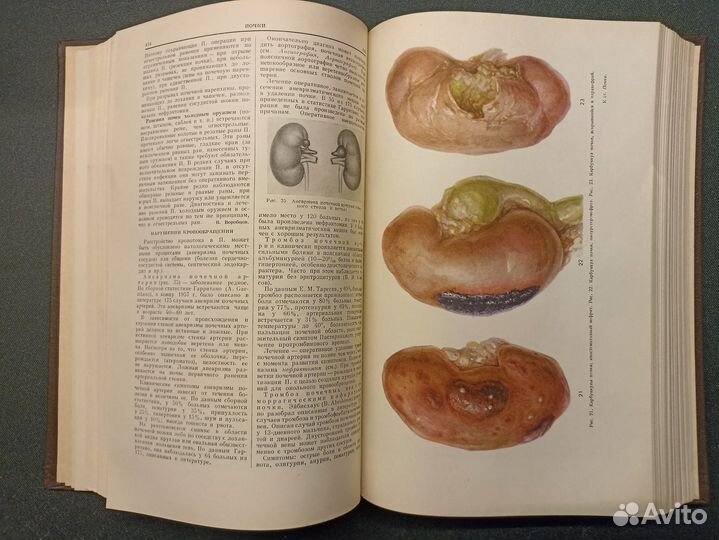 Большая медицинская энциклопедия. Том 26. 1962 