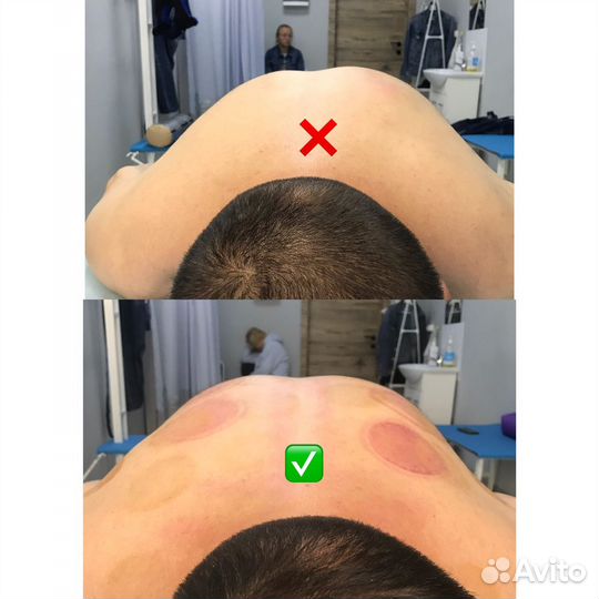 Массаж лечебно-оздоровительный+ коррекция осанки