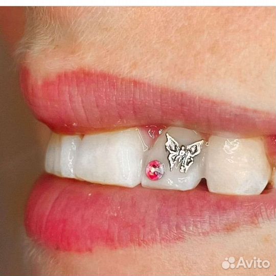 Установка скайсов,твинклов