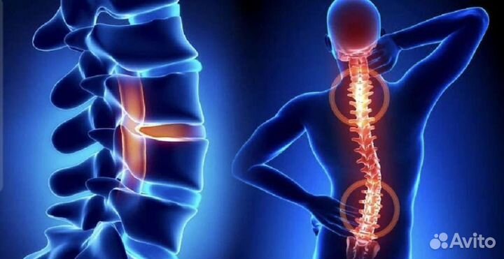 Лечение позвоночника без операции