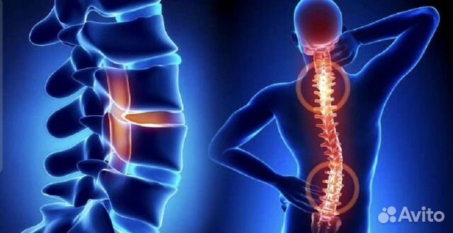 Лечение позвоночника без операции