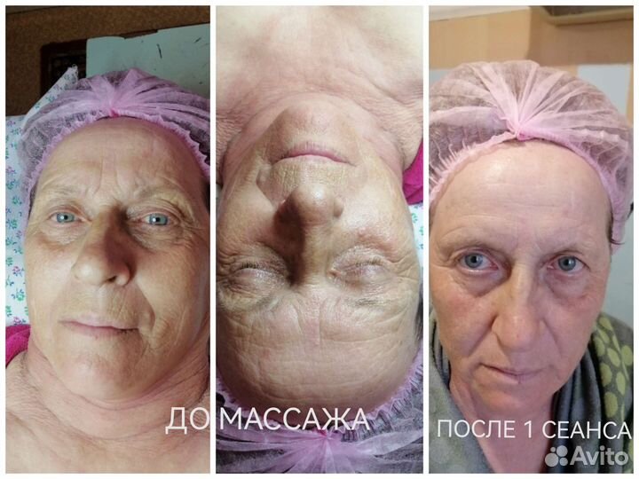 Массаж лица и тела