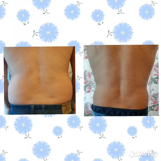 Оздоровительный массаж