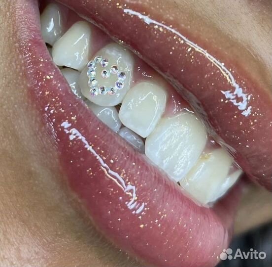 Скайсы и обучение установки скайсам