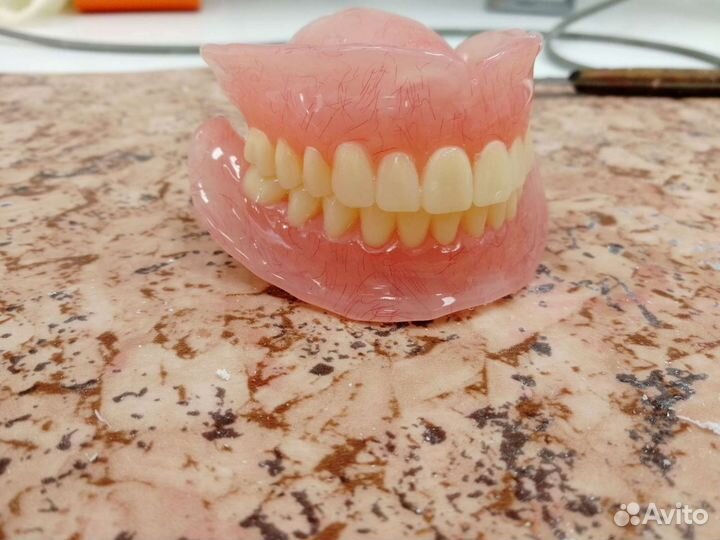 Съёмные Протезы, зубные протезы