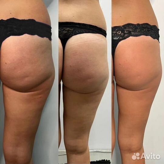 Коррекция фигуры