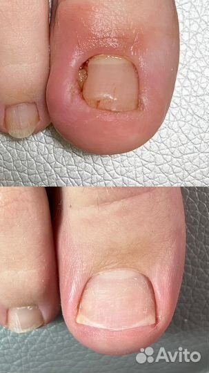 Подолог, проблемы стоп и ногтей, педикюр