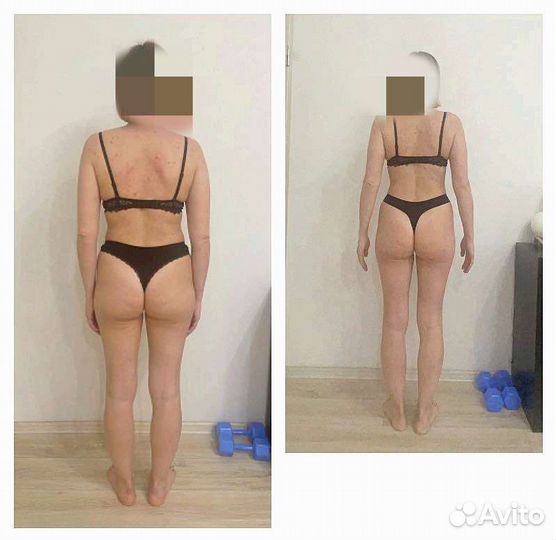 Антицеллюлитный массаж ручной