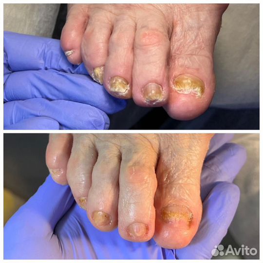 Маникюр Педикюр Подология