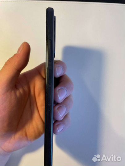 Xiaomi redmi note 11