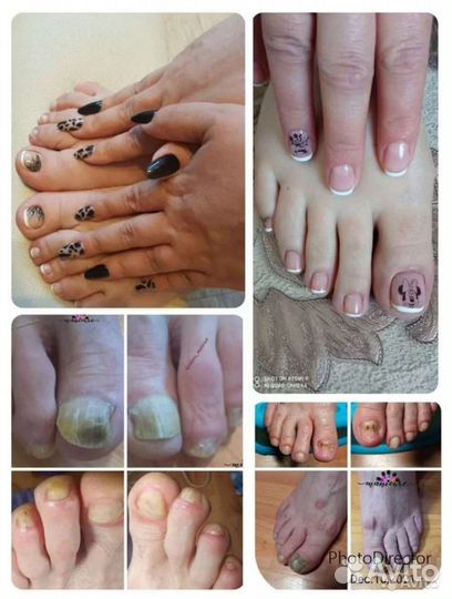 Маникюр/ Педикюр