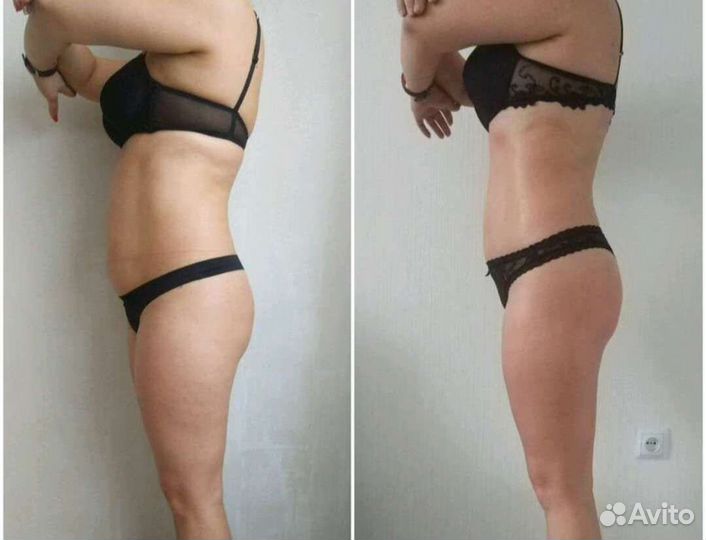 Массаж Антицеллюлитный,Лимфодренажный