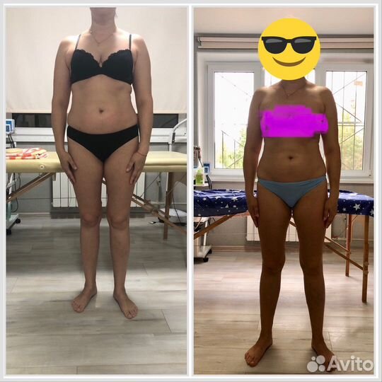 Антицеллюлитный массаж