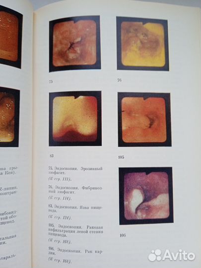 Болезни пищевода и кардии Тамулевичюте Витенас
