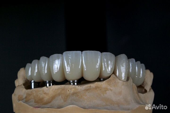 Зуботехническая лаборатория Моделирование Exocad