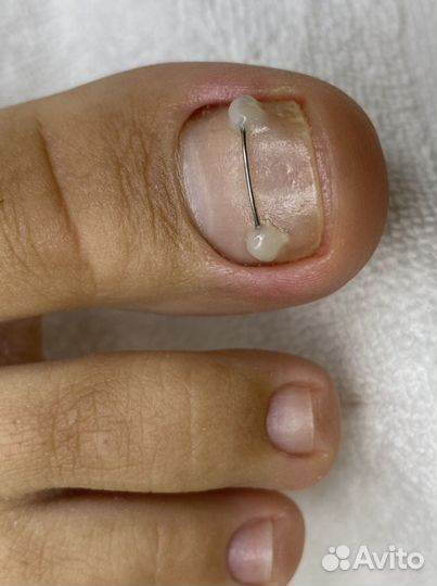 Аппаратный маникюр