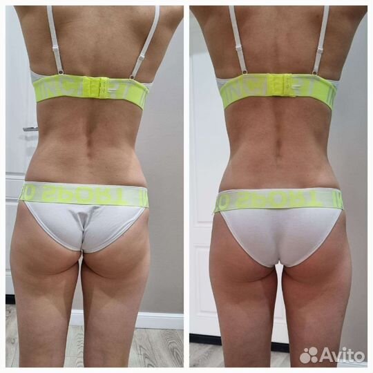 Lpg массаж/Аппаратная методика