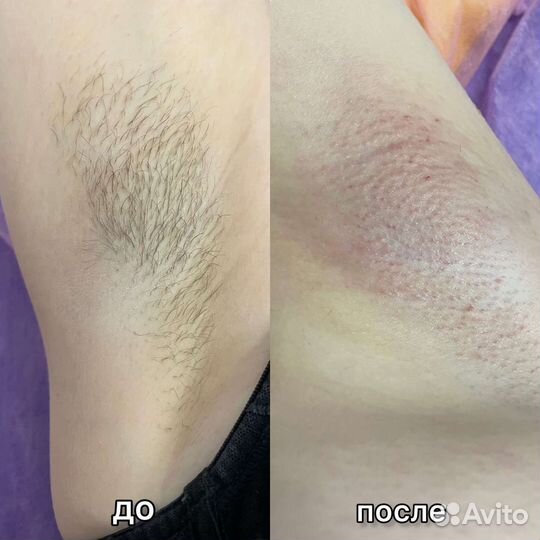 Шугаринг в салоне и с выездом на дом, обучаю тоже