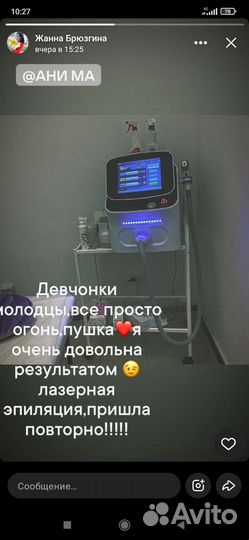 Лазерная эпиляция