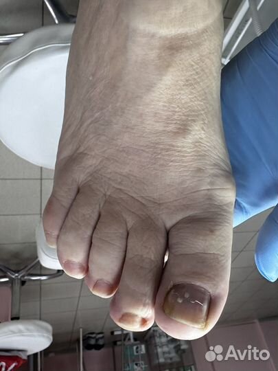 Услуги подолога