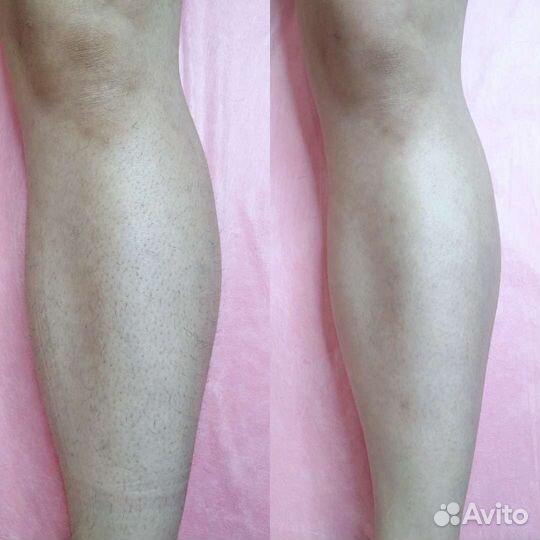 Косметик-эстетист/депиляция/шугаринг/массаж/брови