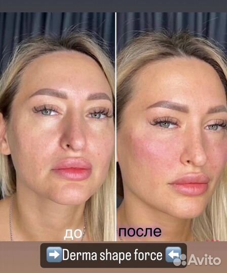 Скульптурный массаж лица