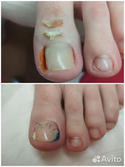 Подолог. Парамедицинский педикюр