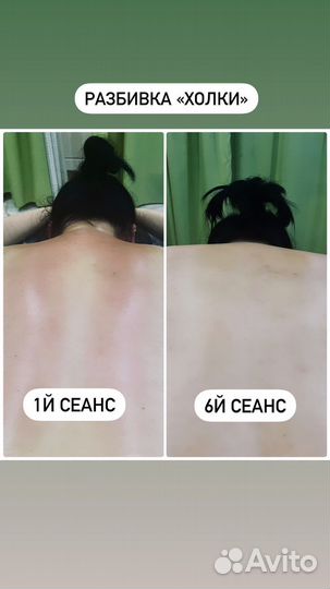 Антистрессовый массаж