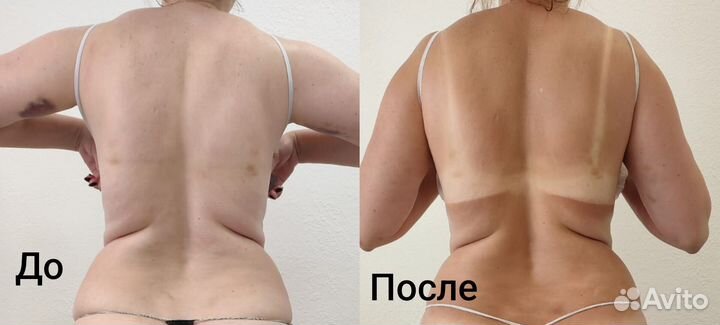 Ручной массаж