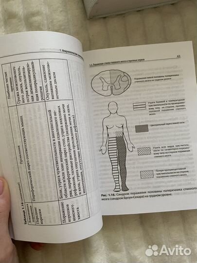 Справочник по нервным болезням мед литература