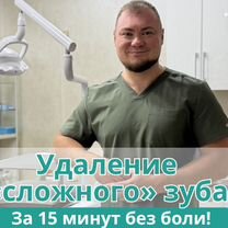 Удаление «сложного» зуба за 15 минут. Без боли, Омск